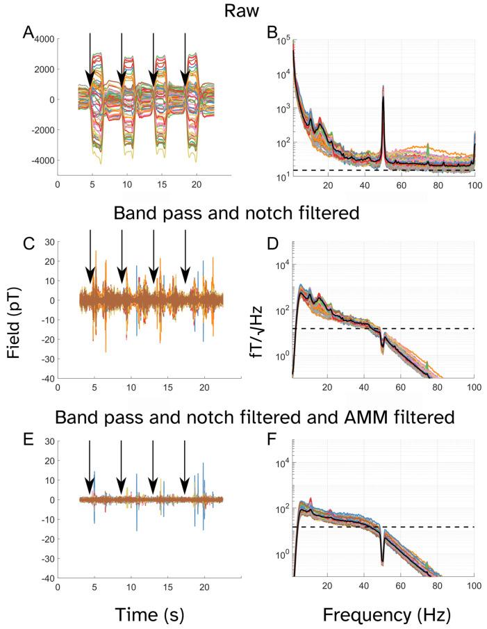 https://cdn.ncbi.nlm.nih.gov/pmc/blobs/10bc/12252452/fe1ced105874/sensors-25-04160-g004.jpg