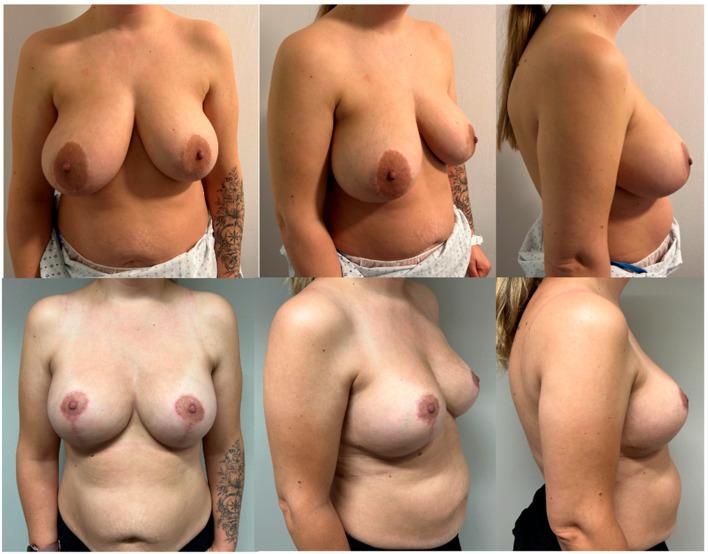 https://cdn.ncbi.nlm.nih.gov/pmc/blobs/10be/11122802/5eaa062f9010/medicina-60-00743-g003.jpg