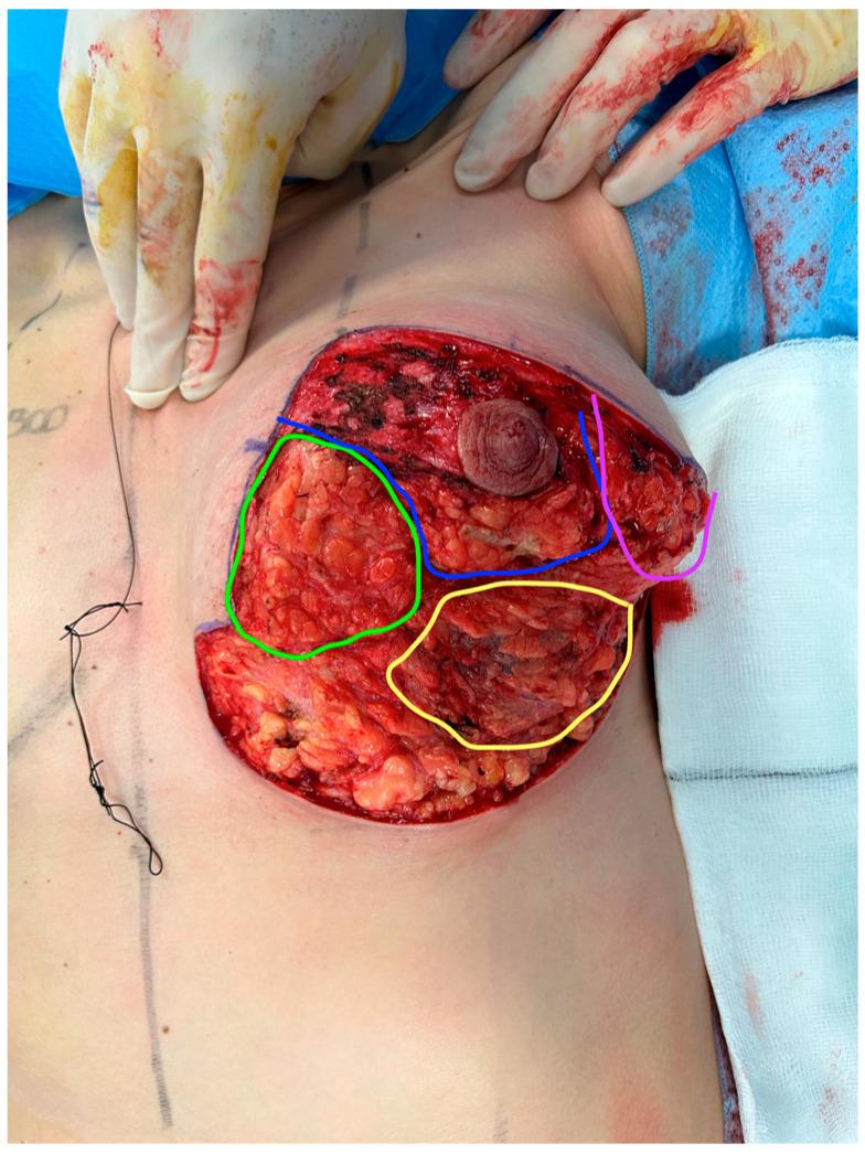 https://cdn.ncbi.nlm.nih.gov/pmc/blobs/10be/11122802/8f2eb7a16de5/medicina-60-00743-g001.jpg