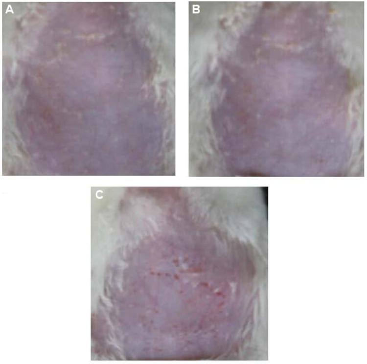 https://cdn.ncbi.nlm.nih.gov/pmc/blobs/10c0/4298334/1d64ea375556/ijn-10-633Fig8.jpg
