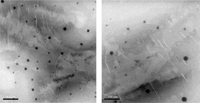 https://cdn.ncbi.nlm.nih.gov/pmc/blobs/10c0/4298334/8f10a2b4fb96/ijn-10-633Fig5.jpg
