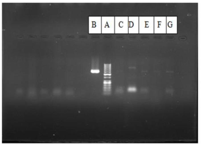 https://cdn.ncbi.nlm.nih.gov/pmc/blobs/10c1/9825699/968ed337a67b/IJPA-17-573-g002.jpg