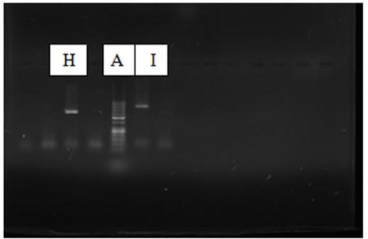 https://cdn.ncbi.nlm.nih.gov/pmc/blobs/10c1/9825699/faffca1e999a/IJPA-17-573-g003.jpg