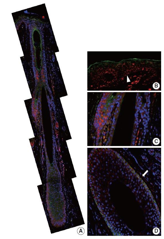 https://cdn.ncbi.nlm.nih.gov/pmc/blobs/10ca/5042900/6bb8b9b6198c/jptm-2016-06-19f4.jpg