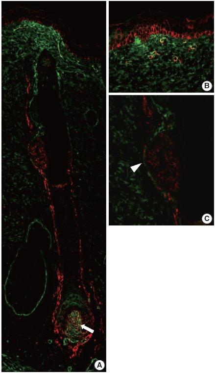 https://cdn.ncbi.nlm.nih.gov/pmc/blobs/10ca/5042900/faae24839f36/jptm-2016-06-19f5.jpg