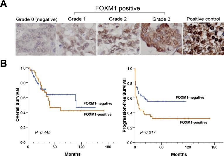 https://cdn.ncbi.nlm.nih.gov/pmc/blobs/10cd/4385856/854f324ff611/oncotarget-06-2349-g011.jpg