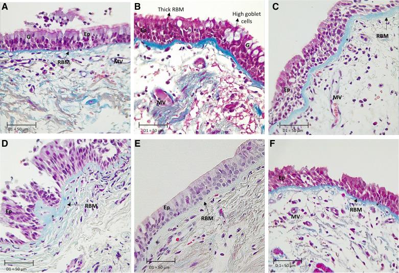 https://cdn.ncbi.nlm.nih.gov/pmc/blobs/10cd/9550567/213651a4b4d2/ajplung.00137.2022_f002.jpg
