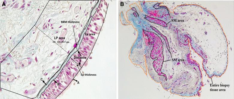 https://cdn.ncbi.nlm.nih.gov/pmc/blobs/10cd/9550567/cd73ab846c4a/ajplung.00137.2022_f001.jpg