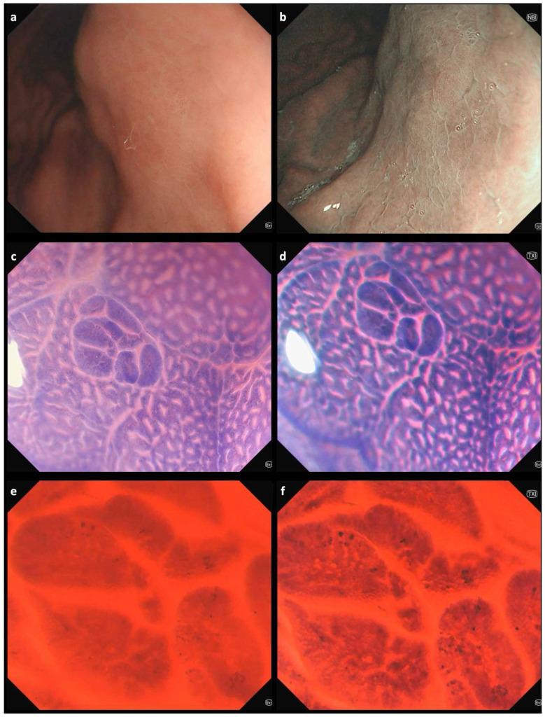 https://cdn.ncbi.nlm.nih.gov/pmc/blobs/10cf/12346551/9735221e2c89/diagnostics-15-01925-g001.jpg