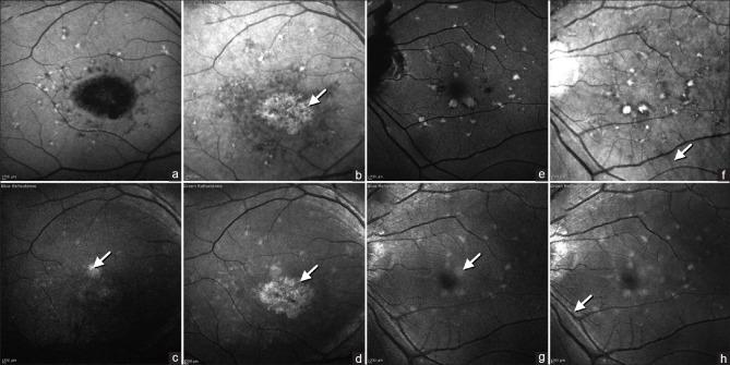 https://cdn.ncbi.nlm.nih.gov/pmc/blobs/10d0/11717338/032cae80463f/TJO-14-486-g006.jpg