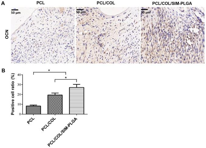 https://cdn.ncbi.nlm.nih.gov/pmc/blobs/10d0/6307523/07c449e5e2a7/etm-17-01-0079-g08.jpg