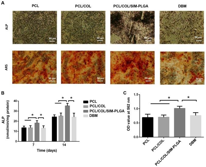 https://cdn.ncbi.nlm.nih.gov/pmc/blobs/10d0/6307523/bc489963b630/etm-17-01-0079-g04.jpg