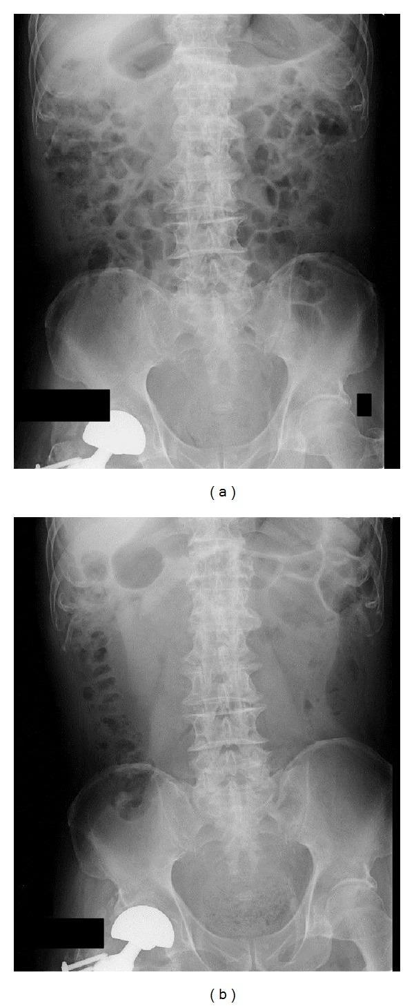 https://cdn.ncbi.nlm.nih.gov/pmc/blobs/10d5/4095989/782fe3b04773/ECAM2014-231258.003.jpg