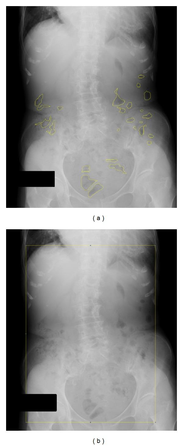 https://cdn.ncbi.nlm.nih.gov/pmc/blobs/10d5/4095989/eca1a7a859f8/ECAM2014-231258.001.jpg