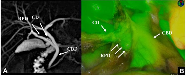 https://cdn.ncbi.nlm.nih.gov/pmc/blobs/10d5/8096340/2849ed762970/CEG-14-145-g0001.jpg