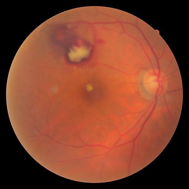 https://cdn.ncbi.nlm.nih.gov/pmc/blobs/10d7/4943772/cf3ff6e7e7bc/cop-0007-0243-g01.jpg
