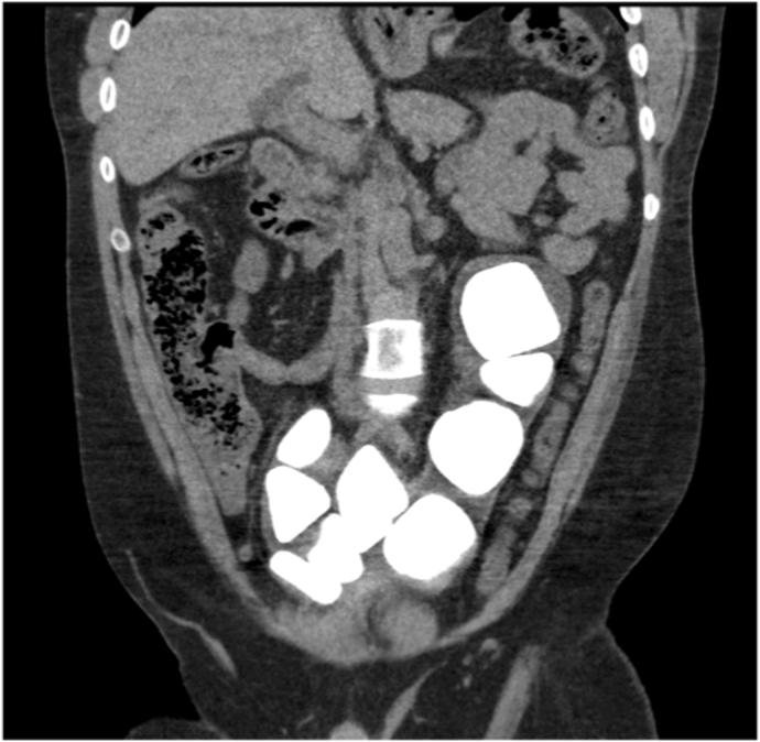 https://cdn.ncbi.nlm.nih.gov/pmc/blobs/10d9/10445452/043dd7ed8e1c/gr2.jpg