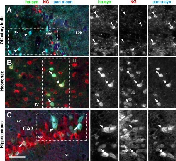 https://cdn.ncbi.nlm.nih.gov/pmc/blobs/10e1/3546911/983b6e932d95/1471-2202-14-6-8.jpg