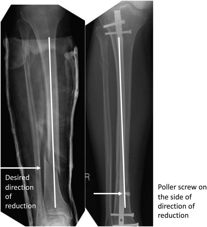 https://cdn.ncbi.nlm.nih.gov/pmc/blobs/10e2/11044090/52230869a8af/EOR-23-0183fig4.jpg