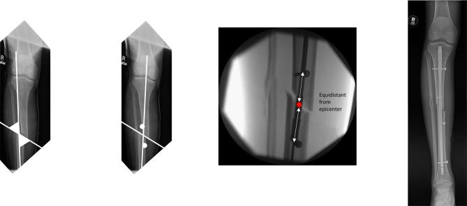 https://cdn.ncbi.nlm.nih.gov/pmc/blobs/10e2/11044090/5b4e603d2049/EOR-23-0183fig6.jpg