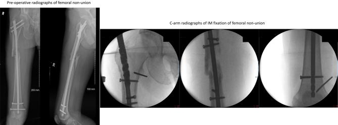 https://cdn.ncbi.nlm.nih.gov/pmc/blobs/10e2/11044090/dfd1d037be88/EOR-23-0183fig8.jpg