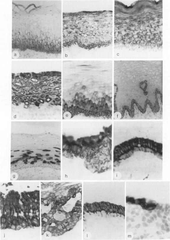 https://cdn.ncbi.nlm.nih.gov/pmc/blobs/10e4/1877502/8f730db73c43/amjpathol00111-0176-a.jpg