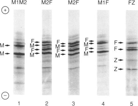 https://cdn.ncbi.nlm.nih.gov/pmc/blobs/10e6/1683089/ac6d3c4bf06a/ajhg00090-0141-a.jpg
