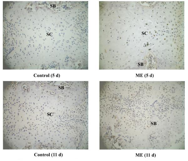 https://cdn.ncbi.nlm.nih.gov/pmc/blobs/10e9/2291465/097556bf4d25/1471-2474-9-37-4.jpg