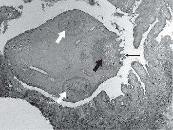 https://cdn.ncbi.nlm.nih.gov/pmc/blobs/10e9/7403940/1ae2a4006b49/JPATH2020-8174240.004.jpg