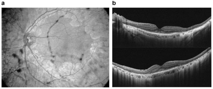 https://cdn.ncbi.nlm.nih.gov/pmc/blobs/10ec/9331776/a5f314dfee74/ijms-23-08182-g005.jpg
