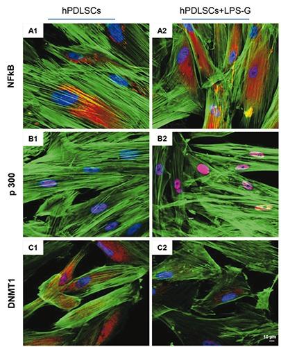 https://cdn.ncbi.nlm.nih.gov/pmc/blobs/10ef/5575416/715e87d98189/ejh-61-3-2826-g002.jpg