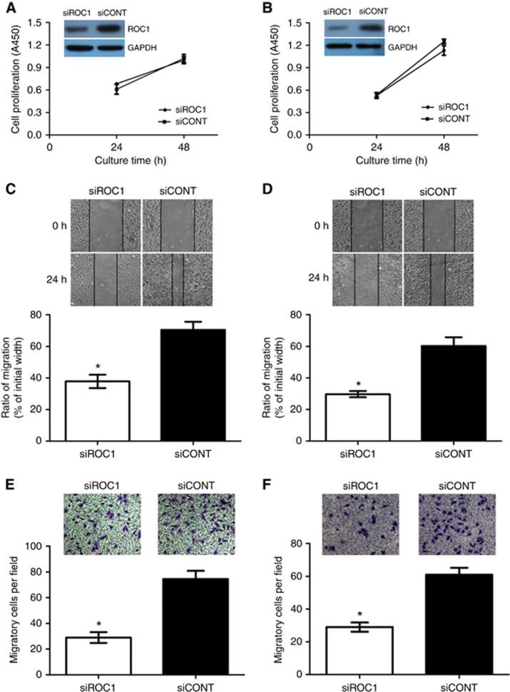 https://cdn.ncbi.nlm.nih.gov/pmc/blobs/10f2/4742580/ad8c26c5b001/bjc2015444f1.jpg