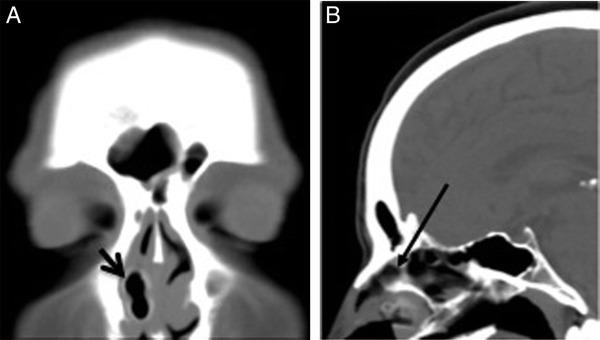 https://cdn.ncbi.nlm.nih.gov/pmc/blobs/10f3/3548615/0f7fd5216c19/arh0021200290002.jpg
