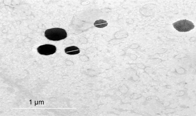 https://cdn.ncbi.nlm.nih.gov/pmc/blobs/10fa/5484509/a9c1f9a24541/dddt-11-1815Fig3.jpg