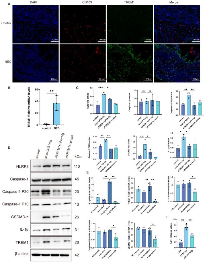 https://cdn.ncbi.nlm.nih.gov/pmc/blobs/10fb/12071306/809c8a4b50c4/ijms-26-04036-g005.jpg