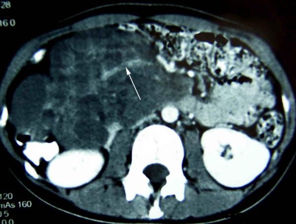 https://cdn.ncbi.nlm.nih.gov/pmc/blobs/1100/2662842/0785b752b47f/1477-7819-7-31-1.jpg