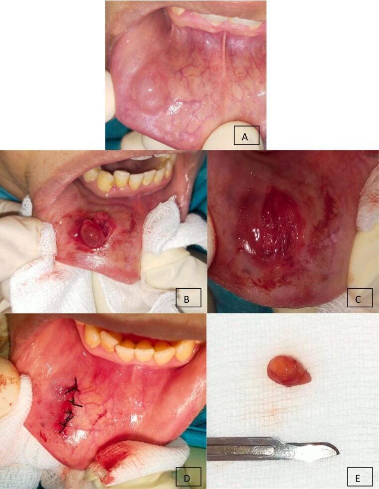 https://cdn.ncbi.nlm.nih.gov/pmc/blobs/1104/10824780/0cdb25a93f22/gr3.jpg