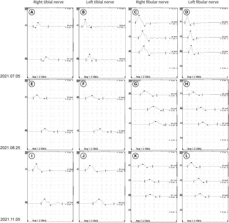 https://cdn.ncbi.nlm.nih.gov/pmc/blobs/110c/9970789/4fbf691909d6/jkms-38-e57-g002.jpg