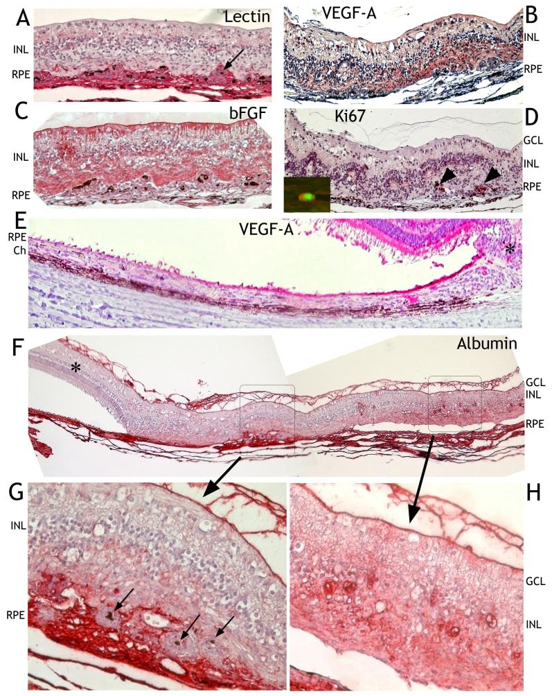 https://cdn.ncbi.nlm.nih.gov/pmc/blobs/110d/2493026/caa13fb88da6/mv-v14-1358-f6.jpg