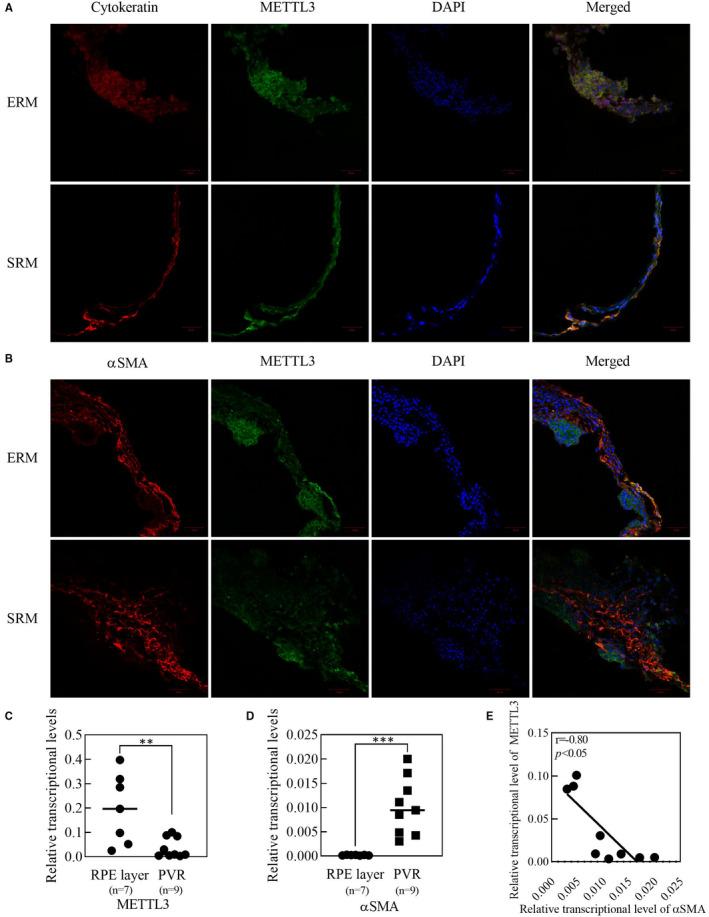 https://cdn.ncbi.nlm.nih.gov/pmc/blobs/110e/8093987/9a786f7e817f/JCMM-25-4220-g004.jpg