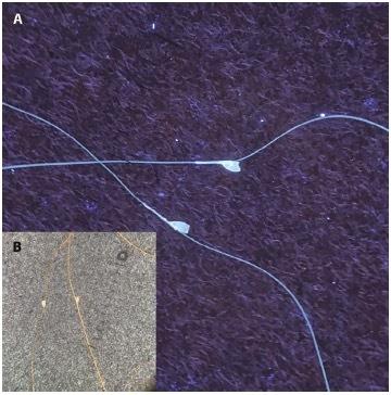https://cdn.ncbi.nlm.nih.gov/pmc/blobs/1117/11314325/0b4f7e333995/dp1403a144g002.jpg