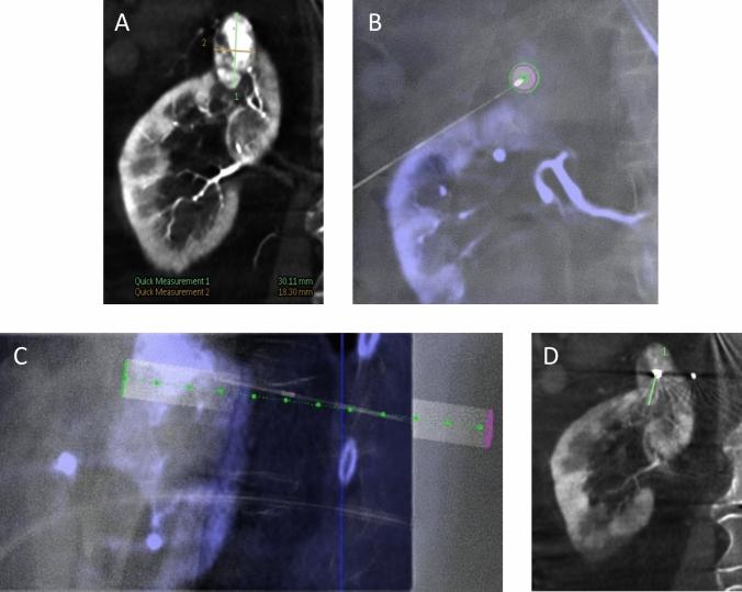 https://cdn.ncbi.nlm.nih.gov/pmc/blobs/1119/12170772/c1b99334b204/270_2025_4039_Fig4_HTML.jpg