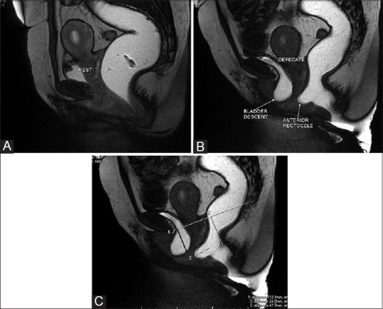 https://cdn.ncbi.nlm.nih.gov/pmc/blobs/111b/4329684/052d8ab611f4/IJRI-25-25-g004.jpg