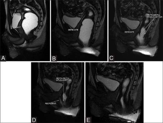 https://cdn.ncbi.nlm.nih.gov/pmc/blobs/111b/4329684/83624bc6c71b/IJRI-25-25-g007.jpg