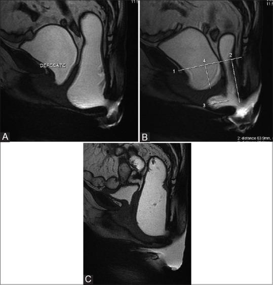 https://cdn.ncbi.nlm.nih.gov/pmc/blobs/111b/4329684/a154331e2a2b/IJRI-25-25-g012.jpg