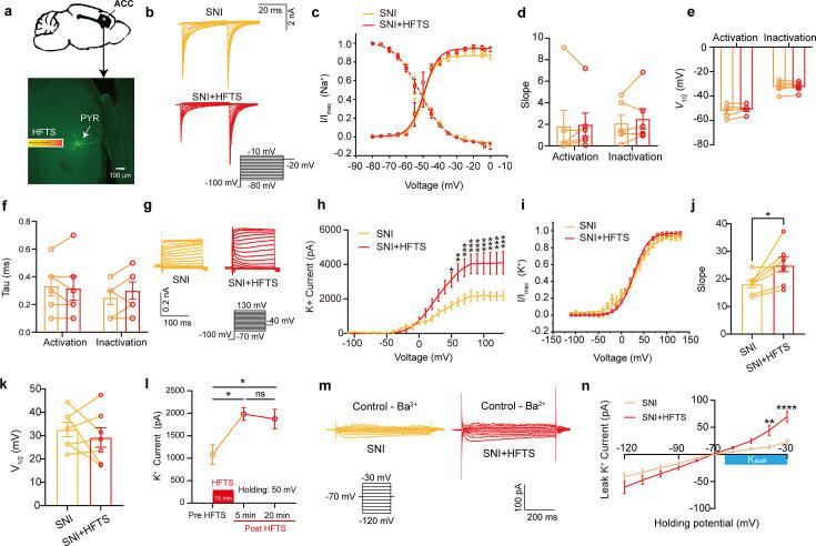https://cdn.ncbi.nlm.nih.gov/pmc/blobs/111f/11434610/e82426a4d6a7/elife-97444-fig2.jpg