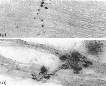 https://cdn.ncbi.nlm.nih.gov/pmc/blobs/1128/1260551/5cff2e65e7e1/janat00154-0260-a.jpg