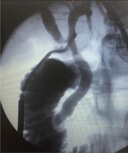 https://cdn.ncbi.nlm.nih.gov/pmc/blobs/112e/9831050/5bd4b73ca846/sla-277-e376-g002.jpg