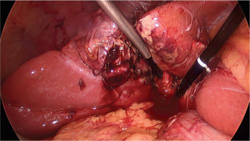 https://cdn.ncbi.nlm.nih.gov/pmc/blobs/112e/9831050/d6335913fd18/sla-277-e376-g001.jpg