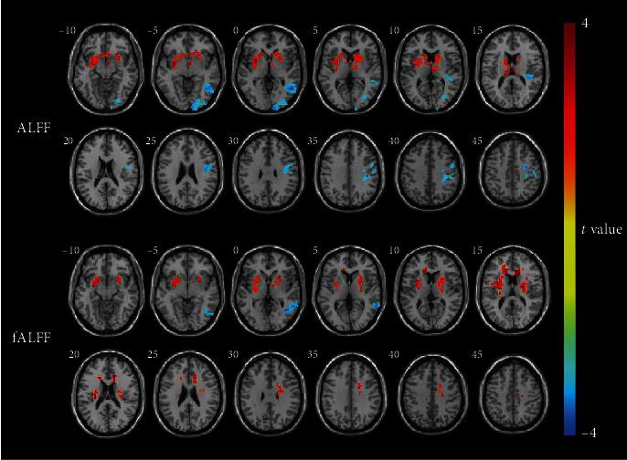 https://cdn.ncbi.nlm.nih.gov/pmc/blobs/113b/7527900/1b8d2771302b/NP2020-9460364.001.jpg